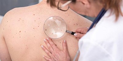 Prendre rendez-vous chez un dermatologue devient mission impossible en 2026